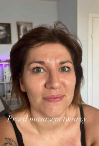 Mioplastyczny masaż twarzy1